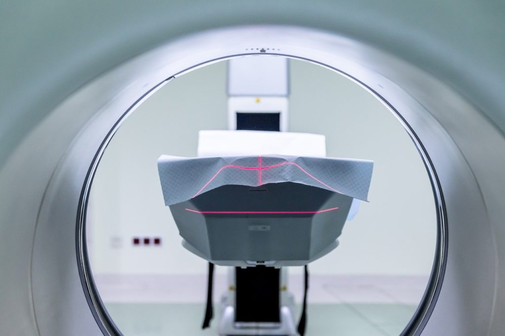 卵巣嚢腫のMRI検査